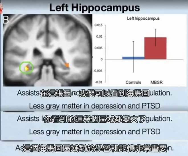 _焦慮症_抑郁症_焦慮自(zì)評_